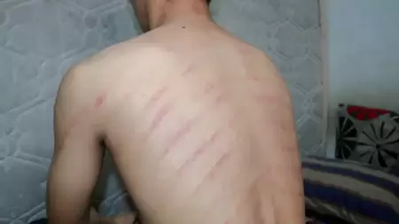 Apakah Masuk Angin Menyebabkan Diare? Ketahui di Sini