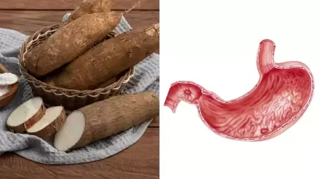 Adakah Bahaya Singkong untuk Lambung?
