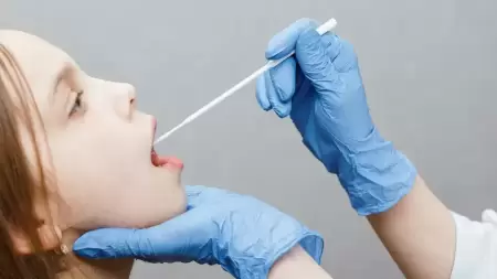 Ini 7 Cara Mengatasi Air Liur Berlebih Akibat Asam Lambung
