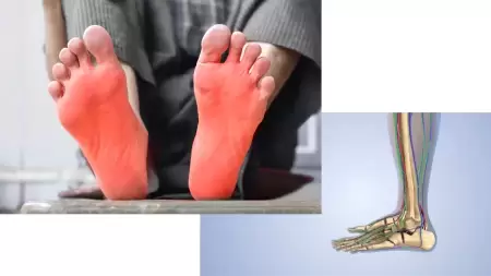 Titik Saraf Asam Lambung di Telapak Kaki yang Tak Banyak Orang Tahu