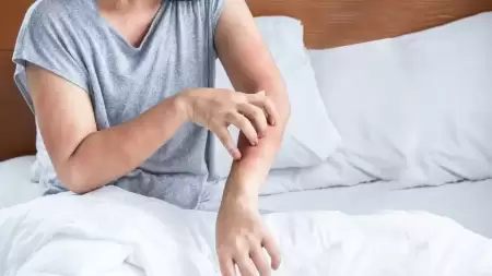 Hubungan Asam Lambung dengan Gatal Kulit? Apakah Saling Berkaitan?