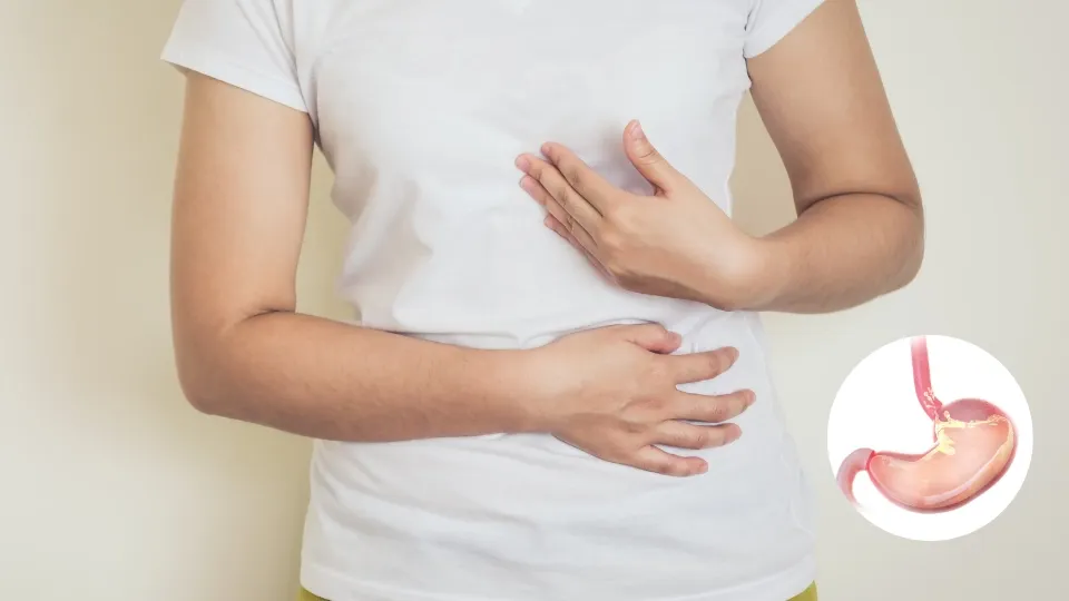 Asam Lambung (GERD): Pengertian, Gejala, Penyebab, dan Cara Mengatasinya